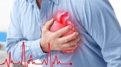 Tìm hiểu về bệnh nhồi máu cơ tim