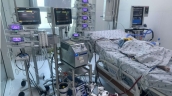 TP. Hồ Chí Minh: Can thiệp ECMO cứu sống 1 trường hợp bé gái 3 tuổi viêm phổi do cúm A/H1 biến chứng suy hô hấp nặng