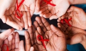 Triệu chứng bệnh HIV