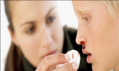 Chảy máu mũi là dấu hiệu bệnh gì?
