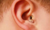 3 bệnh về tai ở trẻ nhỏ dễ gây điếc