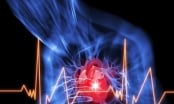 10 loại bệnh về tim mạch dễ gặp nhất