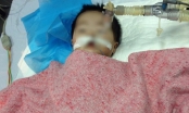 Bé gái 8 tháng tuổi bị tiêm nhầm thuốc có dấu hiệu chết não