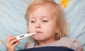 Bộ Y tế cảnh báo dịch bệnh sởi có thể gây tử vong cho trẻ em