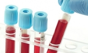 Phương pháp xét nghiệm máu CancerSEEK giúp phát hiện 8 loại ung thư
