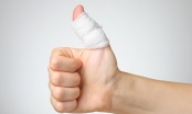 Đau khớp ngón tay cái có nguy hiểm không?