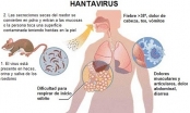 Thời gian ủ bệnh sốt virus hanta bao lâu?