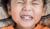 Cách chữa nghiến răng ở trẻ em hiệu quả