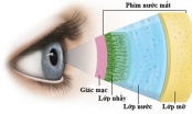 Biện pháp chữa khô mắt hiệu quả