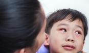 Cách xử lý trẻ em bị đau mắt đỏ