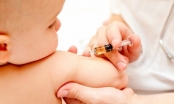 Dấu hiệu nhận biết trẻ bị biến chứng sau tiêm vacxin
