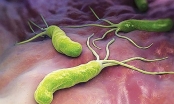 Có bị ung thư nếu nhiễm vi khuẩn Helicobacter Pylori (HP)?