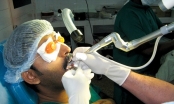 Phương pháp điều trị ung thư vòm họng
