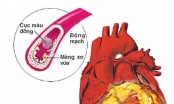 Thông tin mới nhất về bệnh tim mạch vành