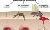 Thông tin mới nhất về bệnh sốt rét