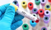 Các nguyên nhân có thể lây nhiễm HIV nhanh nhất