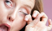 Mắt giật liên tục là bệnh gì và nguy hiểm không?