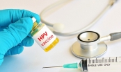 Tại sao phụ nữ nên tiêm vaccine ngừa HPV?