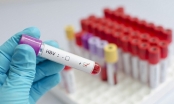 Những xét nghiệm cần thiết khi bị viêm gan B