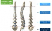 Đau lưng là triệu chứng của bệnh gì? Nguyên nhân và cách chữa hiệu quả