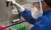 Nga phát minh thiết bị lai sinh học giúp chẩn đoán sớm ung thư và bệnh lao