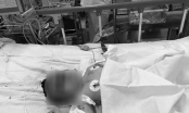 Mẹ bầu và bé 15 tháng tuổi bỏng nặng do bình gas mini phát nổ