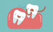 Hạn chế việc đau răng khôn như thế nào
