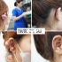 Phú Thọ: Phẫu thuật cắt bỏ sẹo lồi và tạo hình vành tai thành công cho người bệnh nữ 18 tuổi