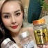 Bộ Y tế yêu cầu xác minh sản phẩm giảm cân do DJ Ngân 98 quảng cáo