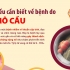 Infographic: Những điều cần biết về bệnh do não mô cầu