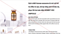 Công ty Cindel Tox bị phạt 210 triệu đồng vì vi phạm trong kinh doanh mỹ phẩm