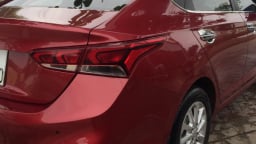Xe Hyundai Accent mới mua có hơi nước trong đèn, đại lý không bảo hành