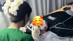 Tràn lan filler giá rẻ, trả giá như mua rau