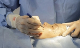 Từ vụ người phụ nữ 70 tuổi tử vong sau phẫu thuật căng da mặt: Bác sĩ khuyến cáo gì?