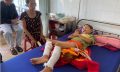 Nghi trộm tiền, cháu bé học lớp 3 bị bố dùng rơm và xăng đốt bỏng 2 chân