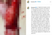 Mina (AOA) viết thư tuyệt mệnh và đăng ảnh cắt tay tự tử lên Instagram