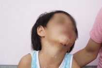 Lại một nghi án cha dượng bạo hành bé gái ở Tây Ninh, dí người vào pô xe