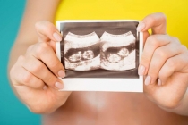 Ca hiếm gặp mang song thai trong 2 tử cung khác nhau