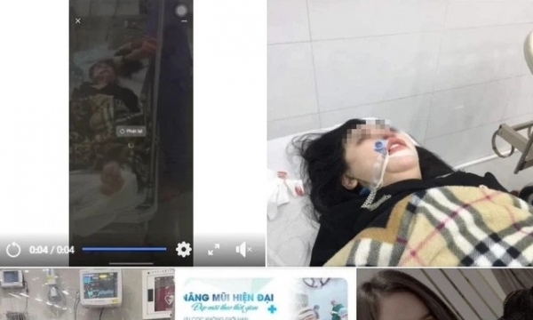 Cô gái trẻ tử vong sau hơn 2 tháng hôn mê do đi nâng mũi tại Hà Nội