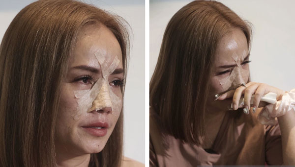 Diện mạo khó tin của diễn viên Hoàng Yến sau khi bị chồng cũ đánh gãy mũi