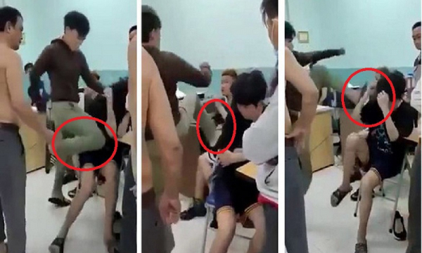 Luật sư: 'Cần truy cứu hình sự bảo vệ dân phố đánh 2 em nhỏ'