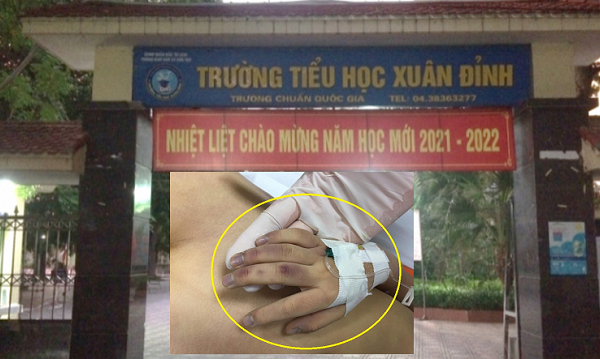 Diễn biến vụ bé gái 6 tuổi tử vong nghi bị bạo hành: Bố đẻ khai có đánh