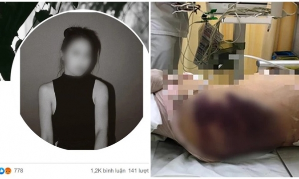 Dân mạng thả phẫn nộ vào Facebook 'dì ghẻ 26 tuổi' nghi bạo hành bé gái 8 tuổi tử vong