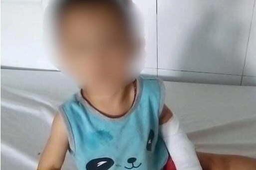 Cập nhật sức khỏe bé 4 tuổi bị gã 'điên vì tình' cắt gân tay