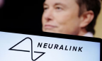Startup Neuralink của Elon Musk lần đầu cấy chip não lên người
