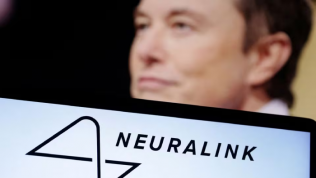 Startup Neuralink của Elon Musk lần đầu cấy chip não lên người