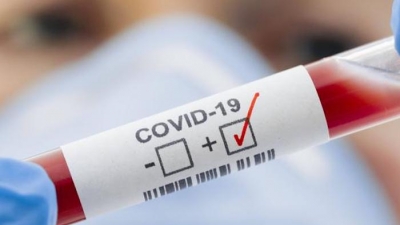 Covid-19 lan rộng, các doanh nghiệp bảo hiểm làm gì để hỗ trợ người nhiễm bệnh?