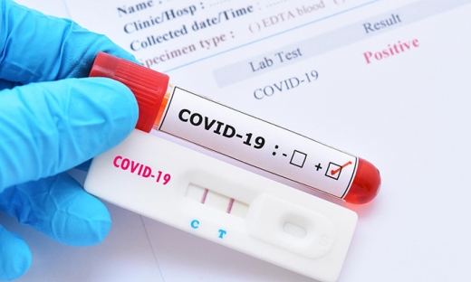 Bộ Y tế: Đang có tình trạng không minh bạch phí xét nghiệm Covid-19, tăng giá so với giá niêm yết