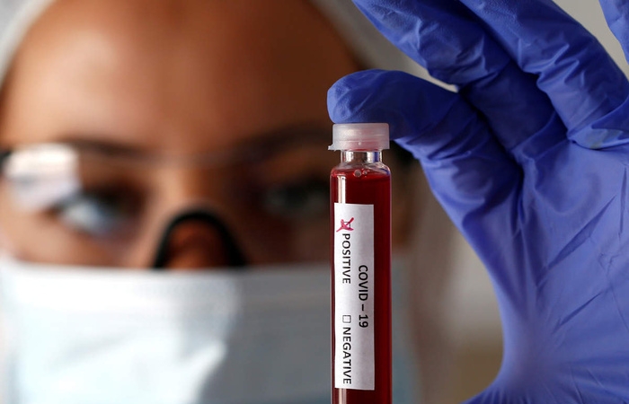 Trung Quốc xét nghiệm hàng chục nghìn mẫu máu ở Vũ Hán để tìm ra ‘bệnh nhân Covid-19 số 0’