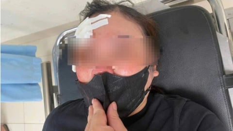 Hà Nội: Xác minh vụ tài xế xe bán tải vụt dùi cui vào đầu người phụ nữ